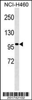 TLE4 Antibody (Center)