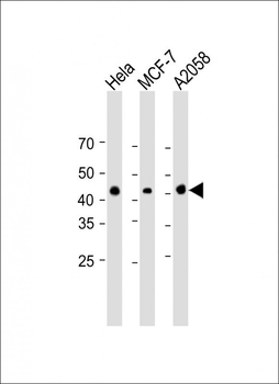 MEK1 Antibody