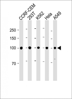 MSH2 antibody