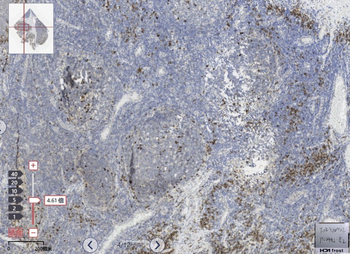 CD38 Antibody