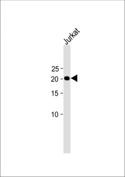 CD3E antibody （C-term)