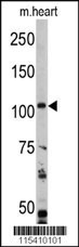 PK3CA Antibody (Y317)