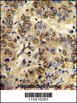 PK3CA Antibody (Y317)