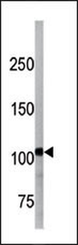 Bi-Phospho-LLGL1/2(S655/659) /(S645/S649) Antibody