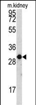 CASP6 Antibody (S257)