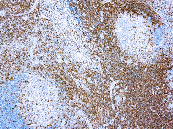 CD3 Antibody