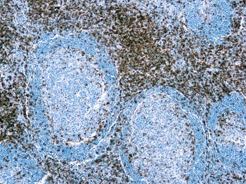 CD3 Antibody