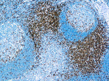 CD3 Antibody