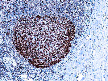 PCNA Antibody