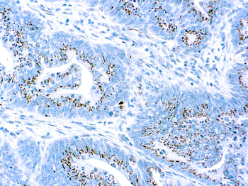 CASPASE 3 Antibody