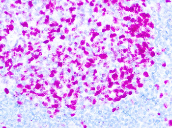KI-67 Antibody