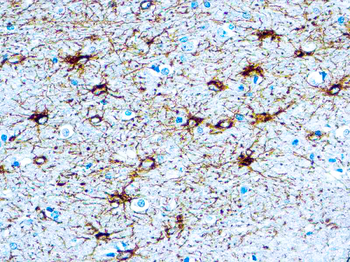 GFAP Antibody