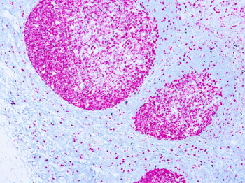 KI-67 ANTIGEN Antibody