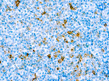CD25 IL-2 Antibody