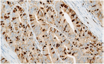 Survivin Antibody