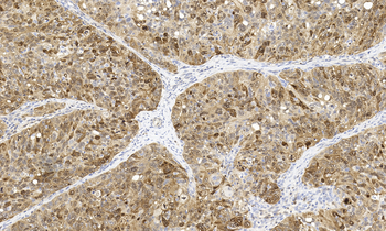 Stathmin Antibody