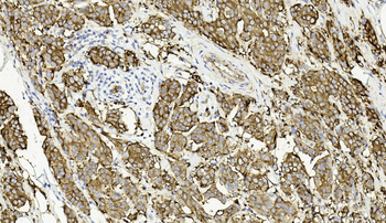 HSP27 Antibody