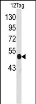 VSV-g Tag Antibody