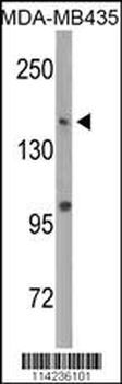 DNMT1 Antibody (S1105)
