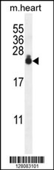 AP1S3 Antibody (N-term)