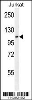 JHDM1a/FBXL11 Antibody (Center)