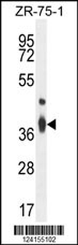 TMBIM4 Antibody (N-term)