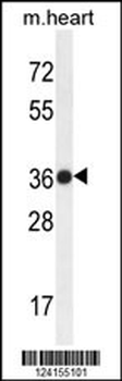 TMBIM4 Antibody (N-term)