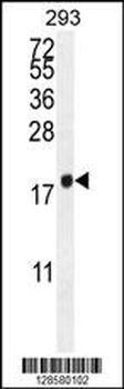 PCOTH Antibody (Center)