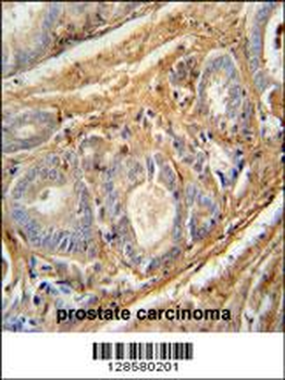 PCOTH Antibody (Center)