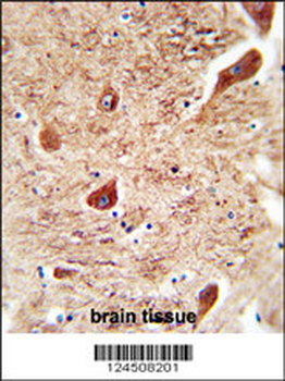 CORO7 Antibody (N-term)