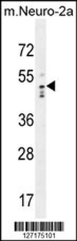 WDSOF1 Antibody (C-term)