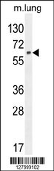 NFE2L1 Antibody (C-term)