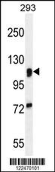 MAN2A1 Antibody (Center)