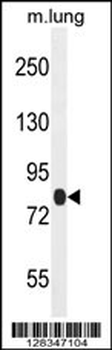 TTC30B Antibody (C-term)