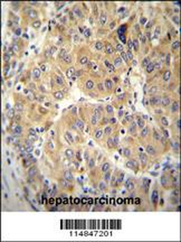 NARS Antibody (N-term)