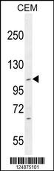 IFT88 Antibody (C-term)