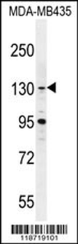 GLTSCR1 Antibody (Center)