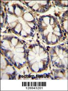 TNFRSF1A Antibody (N-term)