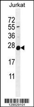 POLR2J Antibody (C-Term)