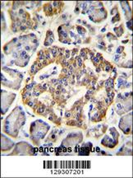 GRIN2A Antibody (C-term)