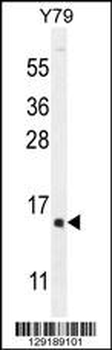 hCG_1995004 Antibody (Center)
