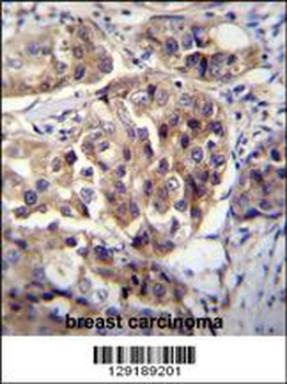hCG_1995004 Antibody (Center)