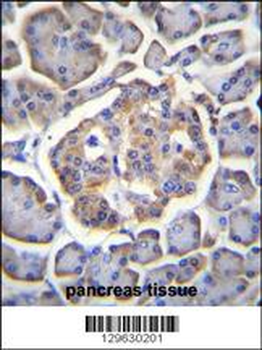 BTBD17 Antibody (C-term)