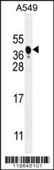 NIX Antibody (Center)