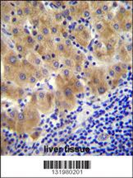 GGH Antibody (C-term)