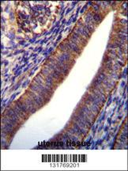 COL21A1 Antibody (N-term)