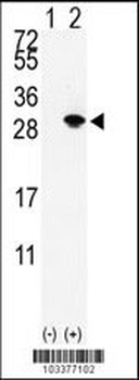 SUMO2/3 Antibody (Center)