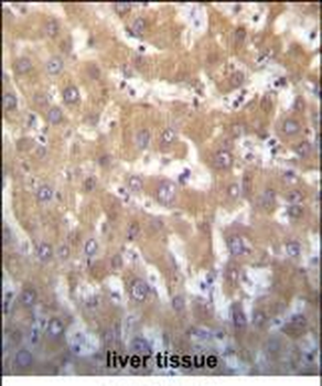 JARID1A Antibody (C-term)