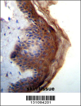 IL1F5 Antibody (N-term)
