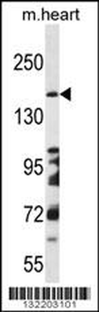 DCC Antibody (Center)